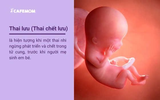 Thai lưu là gì?